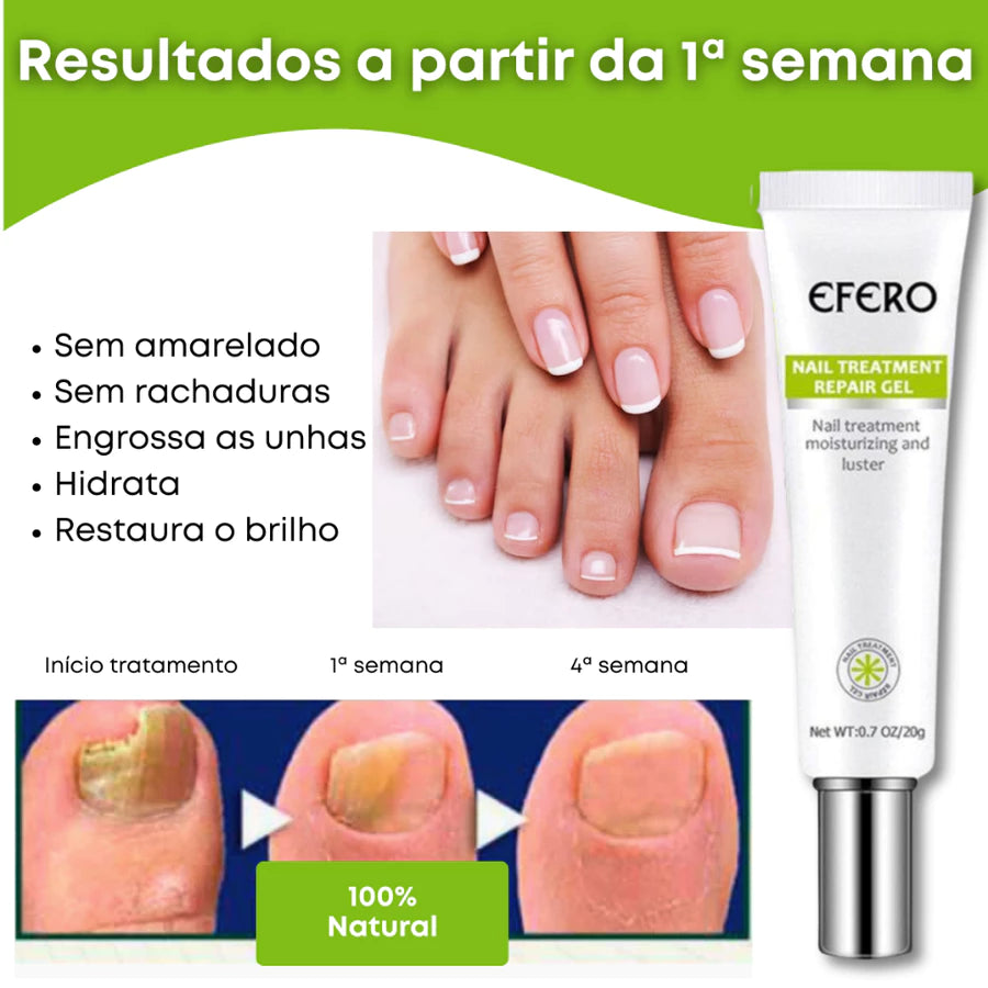 Gel Efero Nail – Tratamento Antifúngico para Unhas (20g)