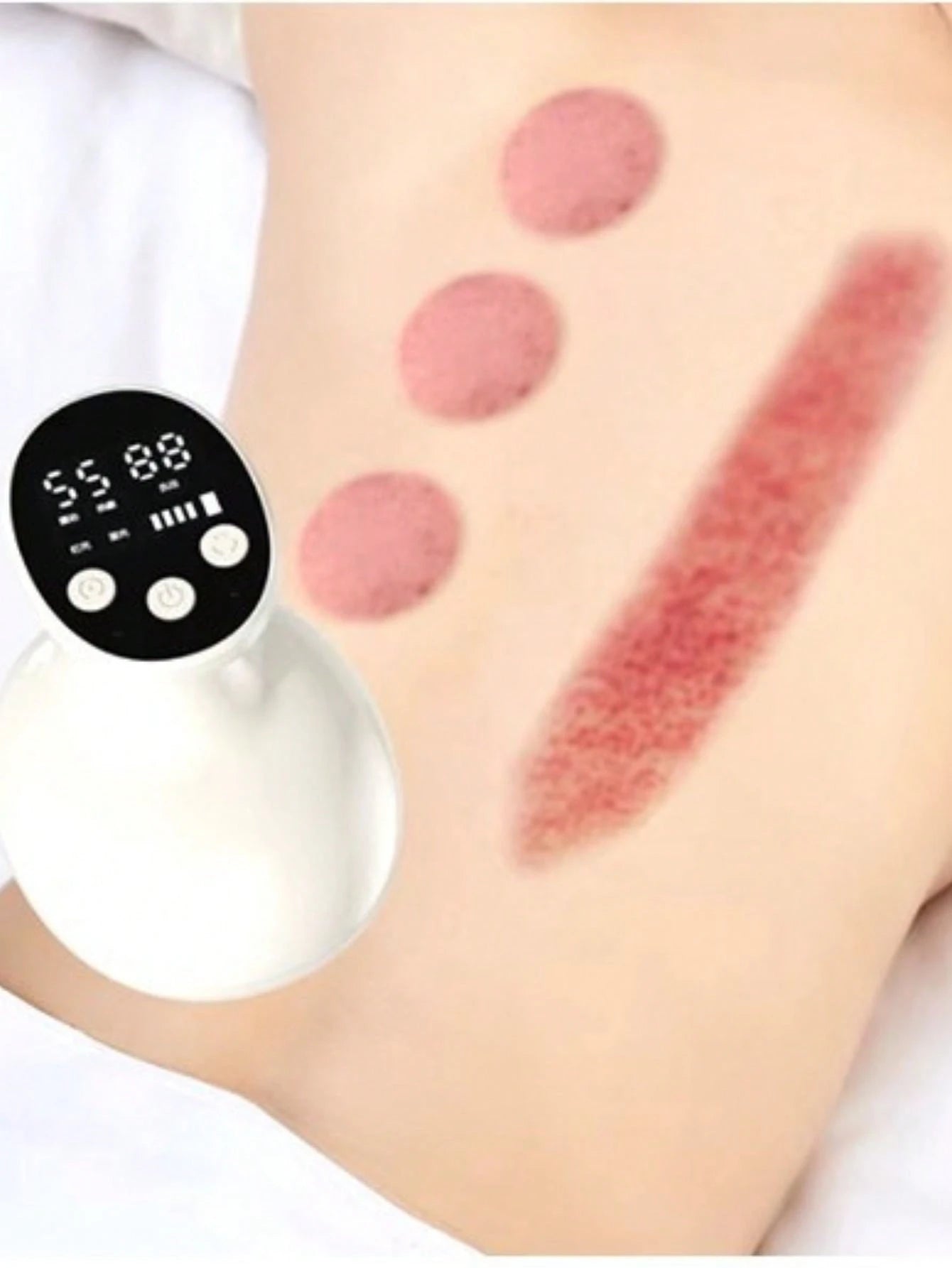 Domeasy Ventosa Elétrico Massageador A Vácuo Sucção Massoterapia Chinesa Corporal Emagrecimento Tensão Lesão Muscular