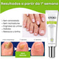 Gel Efero Nail – Tratamento Antifúngico para Unhas (20g)